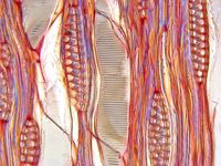 Tangential section